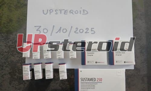 06/11/2025 - Metzeresche - FRANCE