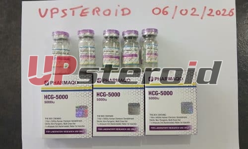 16/02/2026 - Metzeresche - France